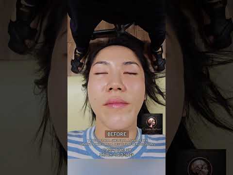 크라니오 리페이스 실전임상｜단 2회 관리 후..
